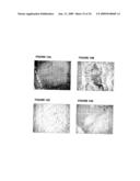 Antibodies against cd38 for treatment of multiple myeloma diagram and image