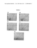 Antibodies against cd38 for treatment of multiple myeloma diagram and image