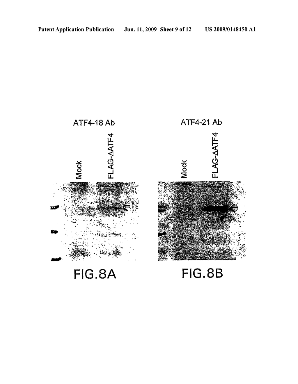 ATF4 As A Therapeutic Target In Alzheimers Disease And Other Neurological Disorders - diagram, schematic, and image 10