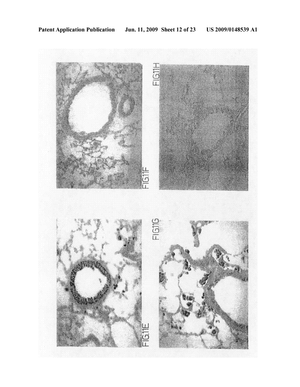 Methods, compositions, and kits relating to chitinases and chitinase-like molecules and inflammatory disease - diagram, schematic, and image 13