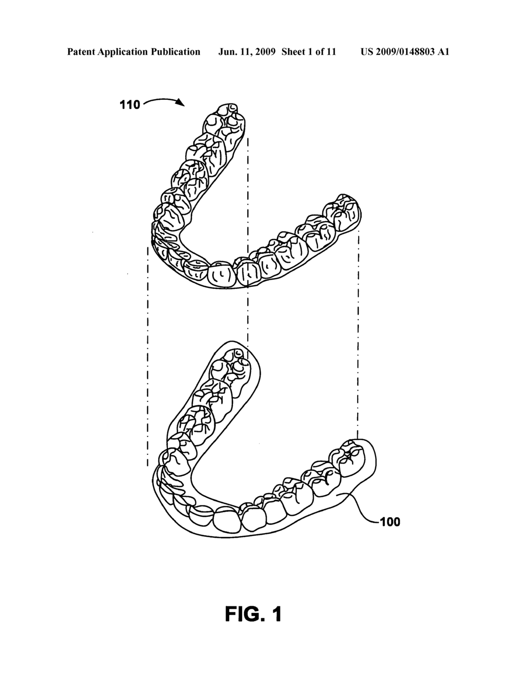 Activatable dental appliance - diagram, schematic, and image 02