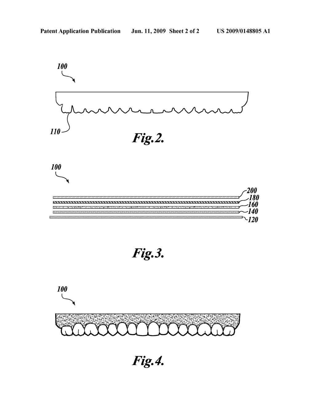 PREVISUALIZATION OF DENTAL WORK - diagram, schematic, and image 03