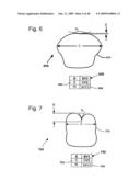 DESIGN OF DENTAL APPLIANCES diagram and image