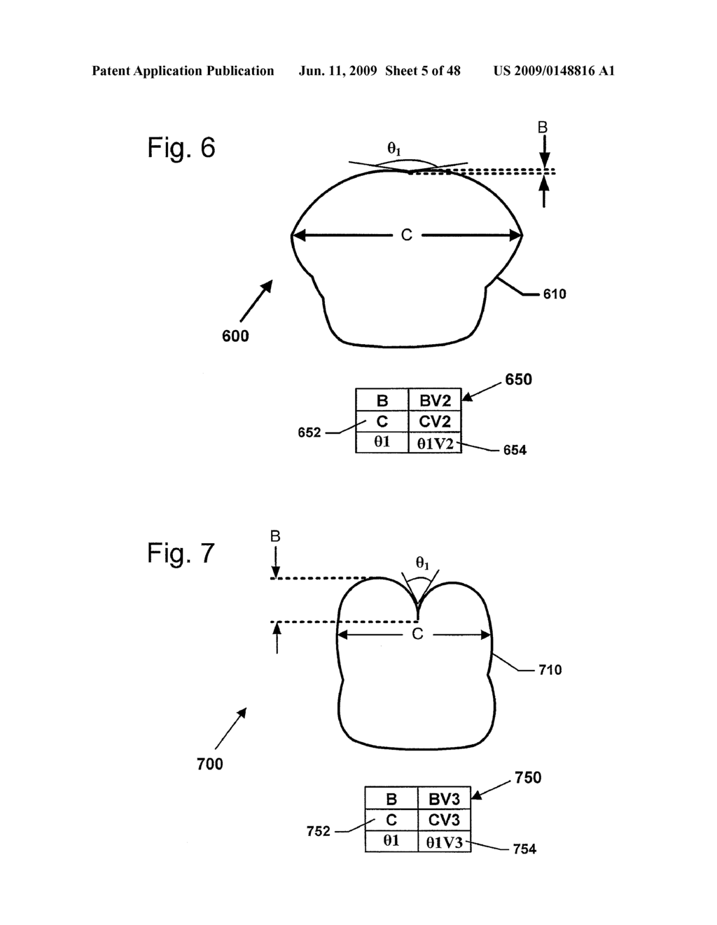 DESIGN OF DENTAL APPLIANCES - diagram, schematic, and image 06