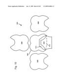 DESIGN OF DENTAL APPLIANCES diagram and image