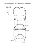 DESIGN OF DENTAL APPLIANCES diagram and image