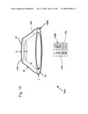 DESIGN OF DENTAL APPLIANCES diagram and image