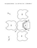 DESIGN OF DENTAL APPLIANCES diagram and image