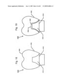 DESIGN OF DENTAL APPLIANCES diagram and image