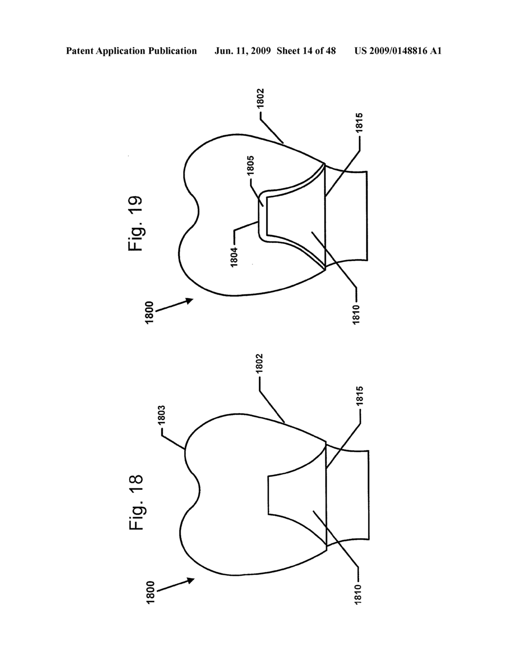 DESIGN OF DENTAL APPLIANCES - diagram, schematic, and image 15