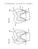 DESIGN OF DENTAL APPLIANCES diagram and image