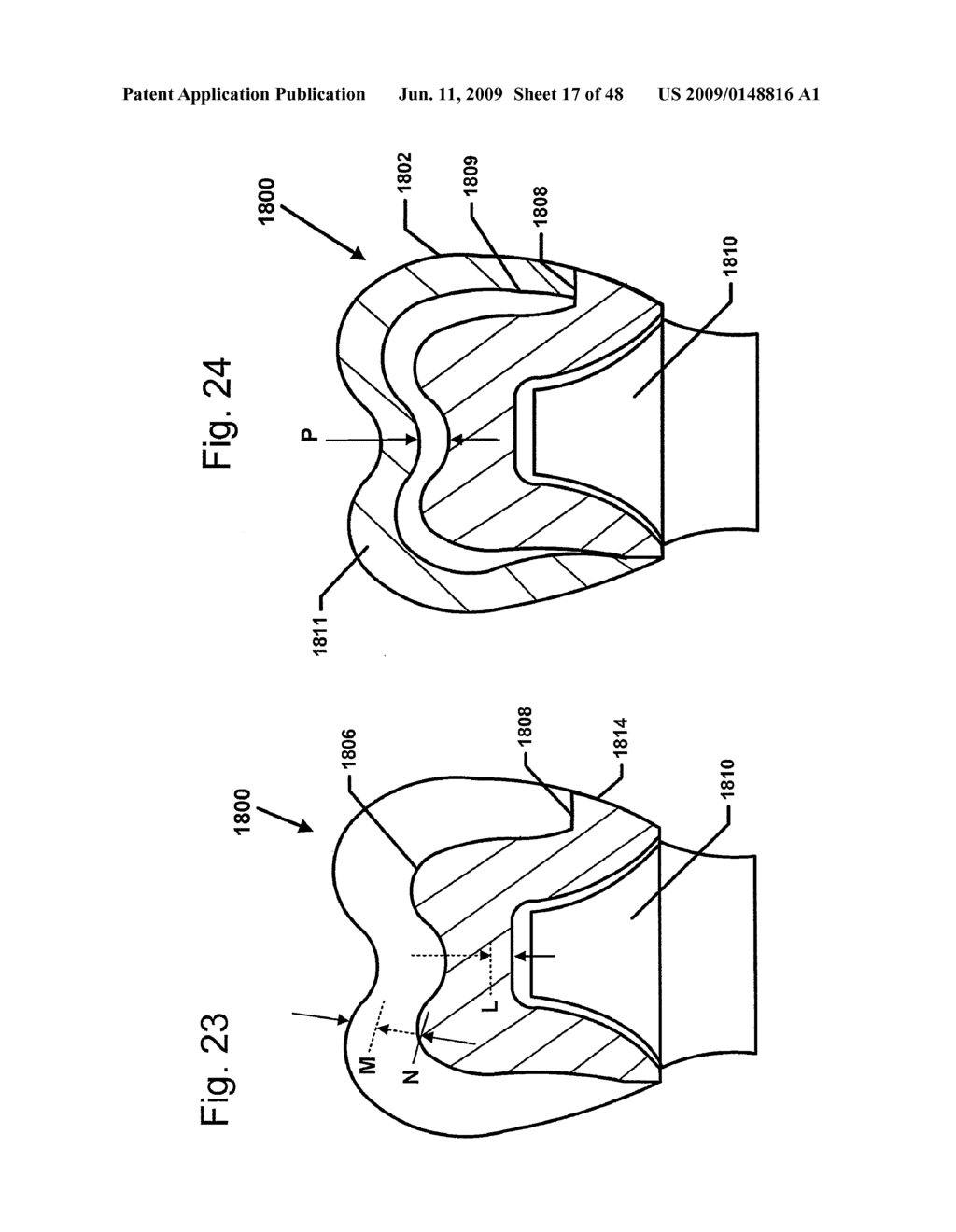 DESIGN OF DENTAL APPLIANCES - diagram, schematic, and image 18