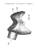 DESIGN OF DENTAL APPLIANCES diagram and image