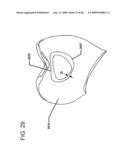 DESIGN OF DENTAL APPLIANCES diagram and image