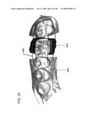 DESIGN OF DENTAL APPLIANCES diagram and image