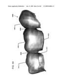 DESIGN OF DENTAL APPLIANCES diagram and image