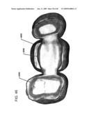 DESIGN OF DENTAL APPLIANCES diagram and image