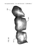 DESIGN OF DENTAL APPLIANCES diagram and image