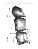 DESIGN OF DENTAL APPLIANCES diagram and image