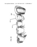 DESIGN OF DENTAL APPLIANCES diagram and image