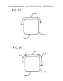 DESIGN OF DENTAL APPLIANCES diagram and image