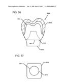 DESIGN OF DENTAL APPLIANCES diagram and image