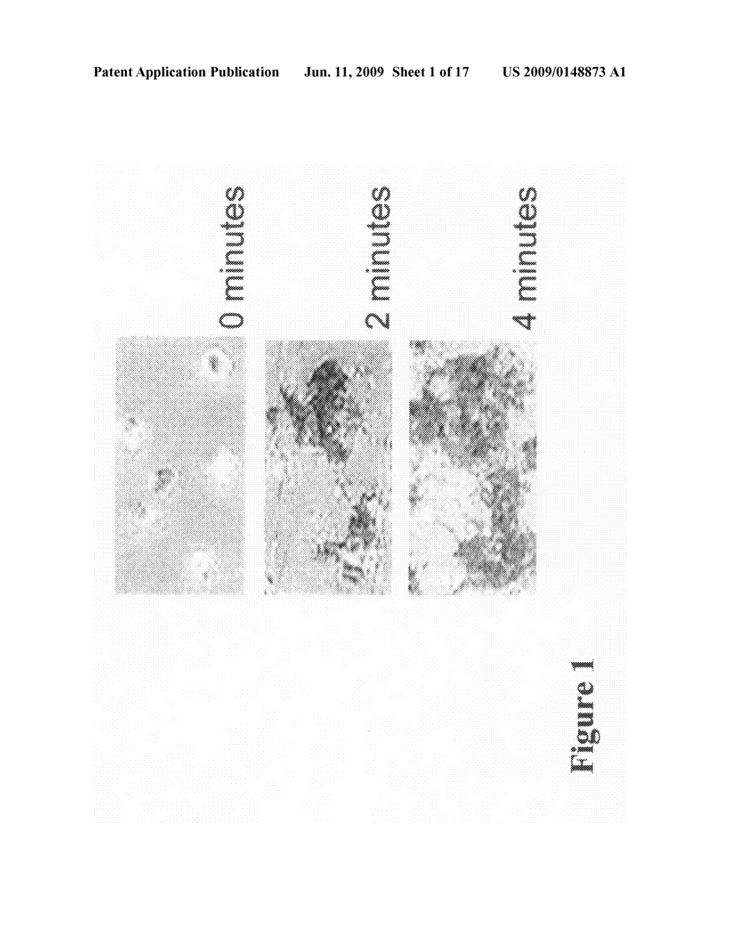 Apparatus and method to measure platelet contractility - diagram, schematic, and image 02