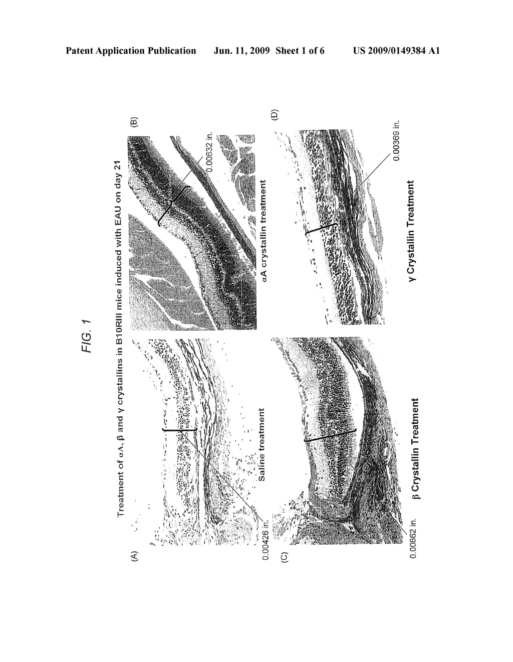 Protection of Photoreceptors in Experimental Autoimmune Uveitis - diagram, schematic, and image 02