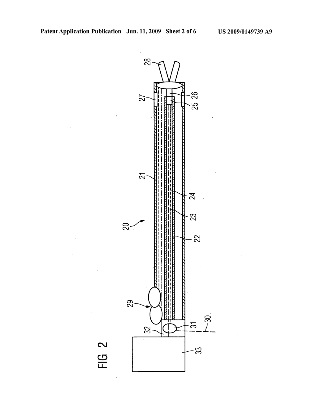 Catheter device with a position sensor system for treating a vessel blockage using image monitoring - diagram, schematic, and image 03