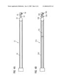 Catheter device with a position sensor system for treating a vessel blockage using image monitoring diagram and image