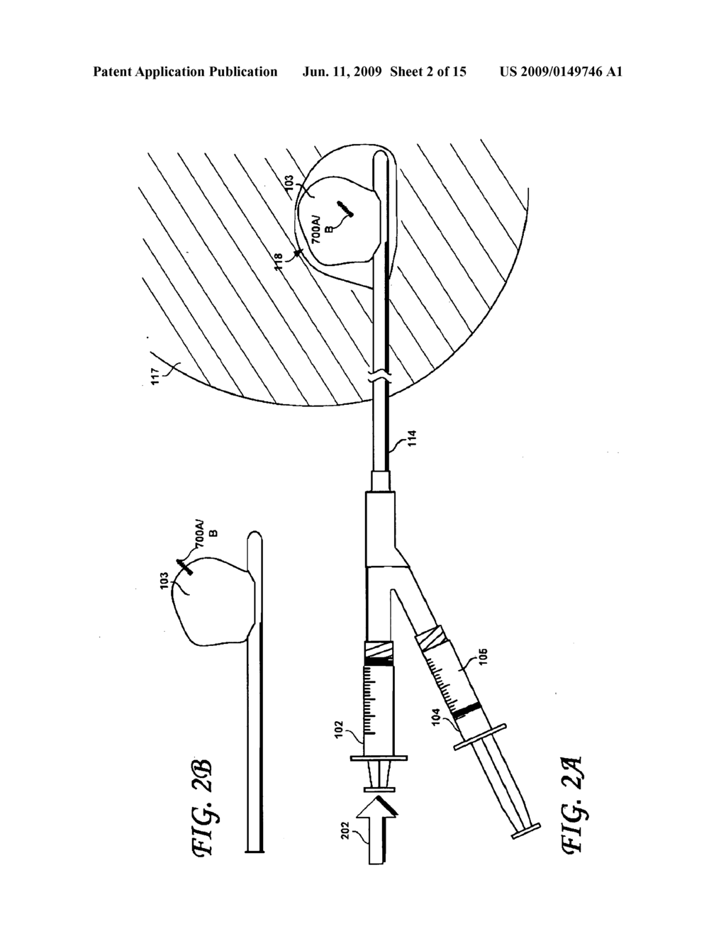 POST-BIOPSY CAVITY TREATMENT IMPLANTS AND METHODS - diagram, schematic, and image 03