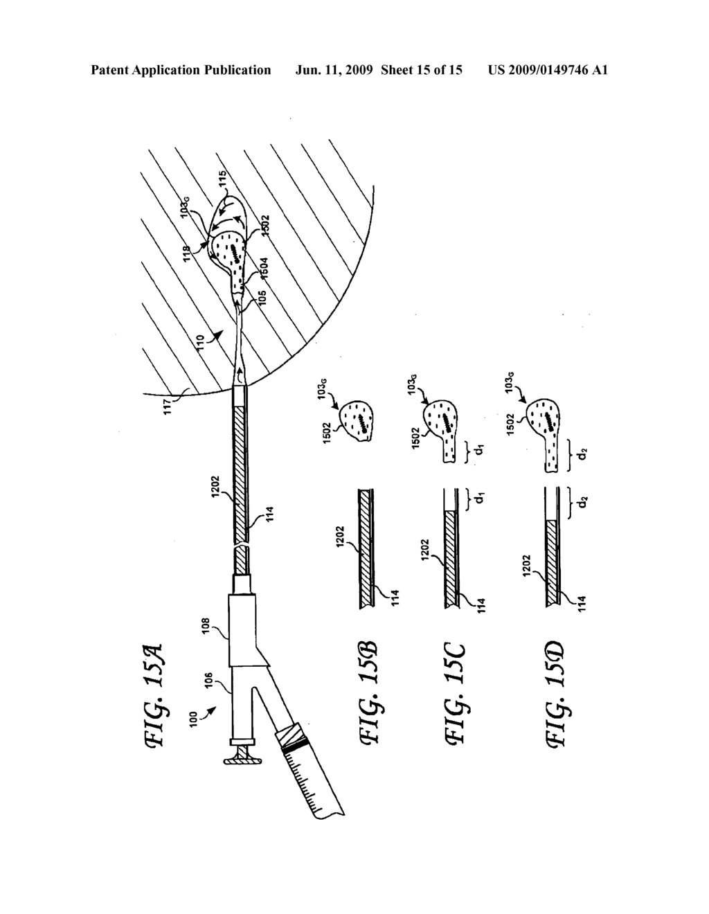 POST-BIOPSY CAVITY TREATMENT IMPLANTS AND METHODS - diagram, schematic, and image 16