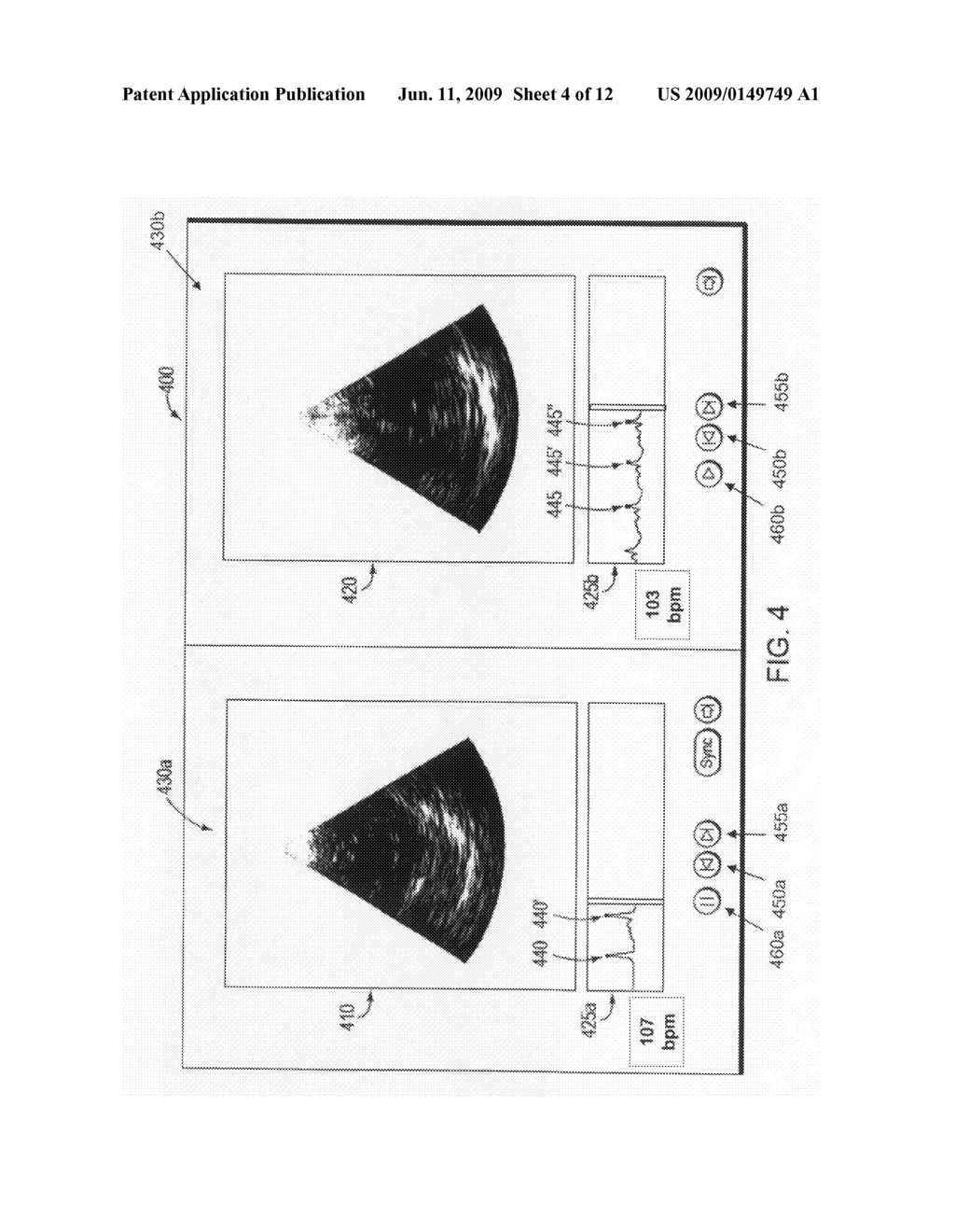 Method and system for synchronized playback of ultrasound images - diagram, schematic, and image 05