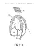 Three Dimensional Ultrasonic Scanning With Live Subvolumes diagram and image