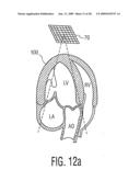 Three Dimensional Ultrasonic Scanning With Live Subvolumes diagram and image