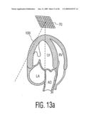 Three Dimensional Ultrasonic Scanning With Live Subvolumes diagram and image