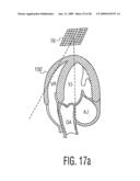 Three Dimensional Ultrasonic Scanning With Live Subvolumes diagram and image