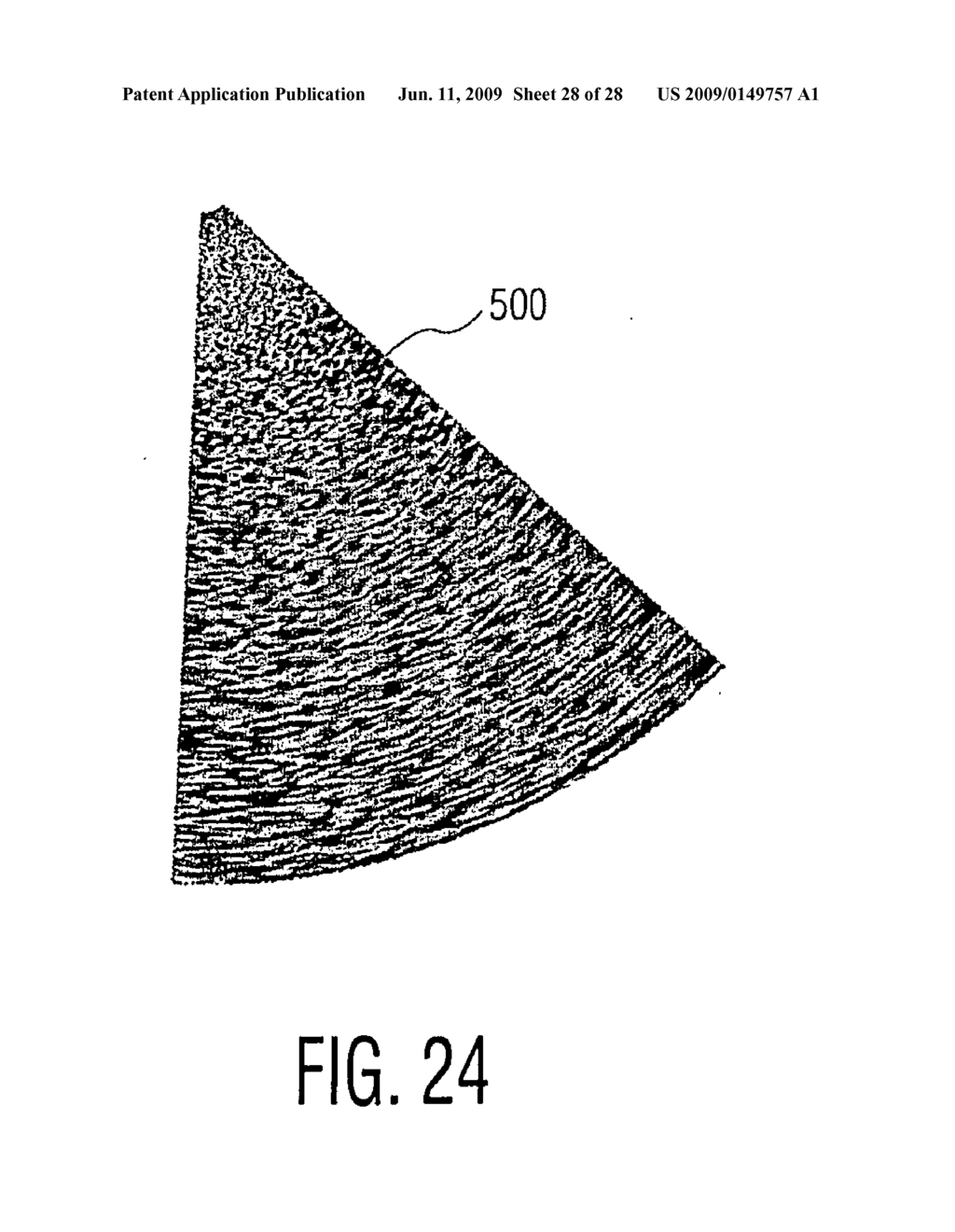 Three Dimensional Ultrasonic Scanning With Live Subvolumes - diagram, schematic, and image 29