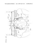 MASSAGE UNIT AND MASSAGE MACHINE OF CHAIR TYPE HAVING THE UNIT diagram and image