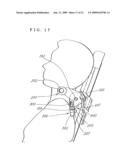 MASSAGE UNIT AND MASSAGE MACHINE OF CHAIR TYPE HAVING THE UNIT diagram and image