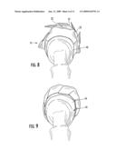 HOOF BANDAGES diagram and image