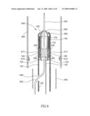 Embolism Filter with Self-Deployable Guidewire Stop diagram and image