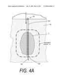 MEDICAL SYSTEM AND METHOD OF USE diagram and image