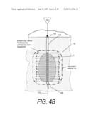 MEDICAL SYSTEM AND METHOD OF USE diagram and image