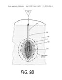 MEDICAL SYSTEM AND METHOD OF USE diagram and image