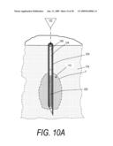 MEDICAL SYSTEM AND METHOD OF USE diagram and image