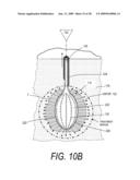 MEDICAL SYSTEM AND METHOD OF USE diagram and image