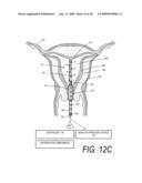 MEDICAL SYSTEM AND METHOD OF USE diagram and image