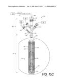 MEDICAL SYSTEM AND METHOD OF USE diagram and image