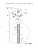 MEDICAL SYSTEM AND METHOD OF USE diagram and image